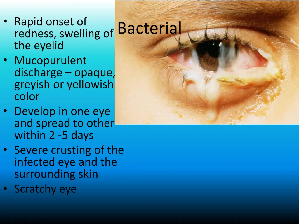rapid onset of redness swelling of the eyelid