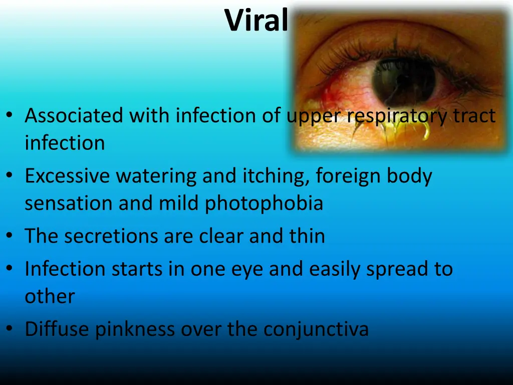viral