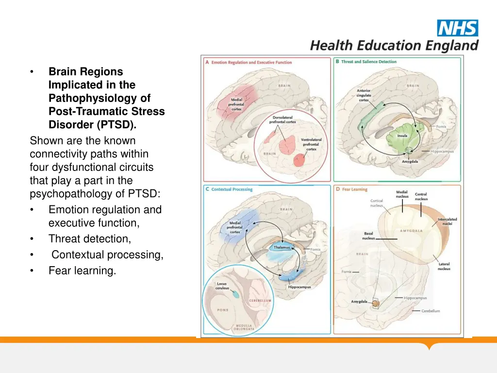 brain regions implicated in the pathophysiology