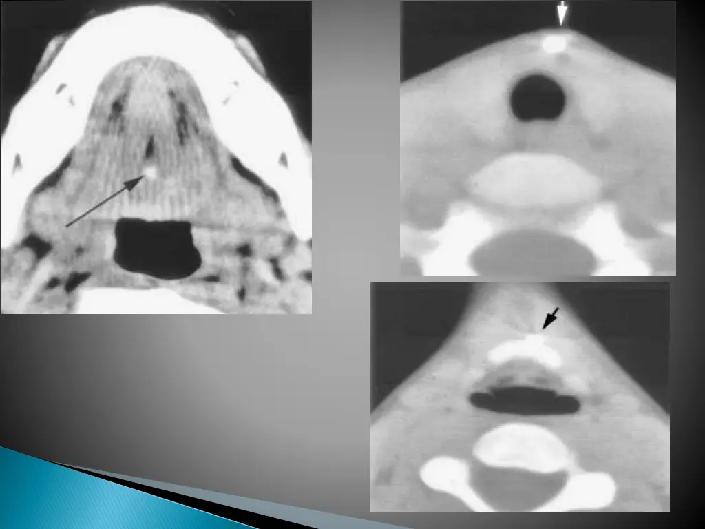slide15
