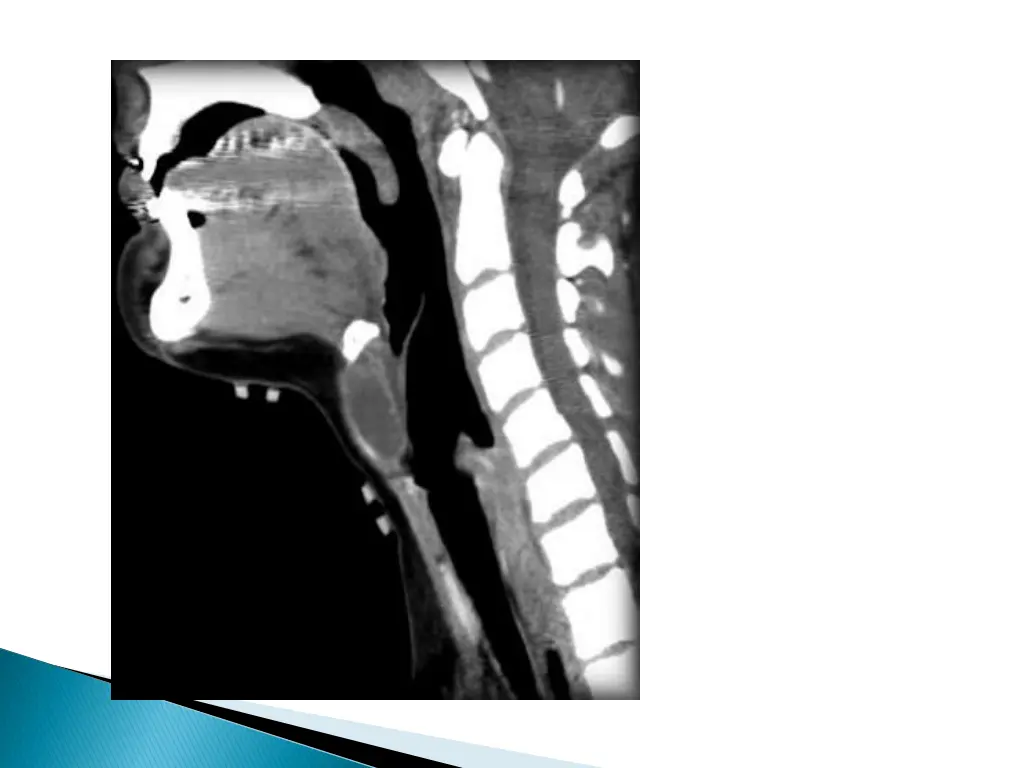slide16
