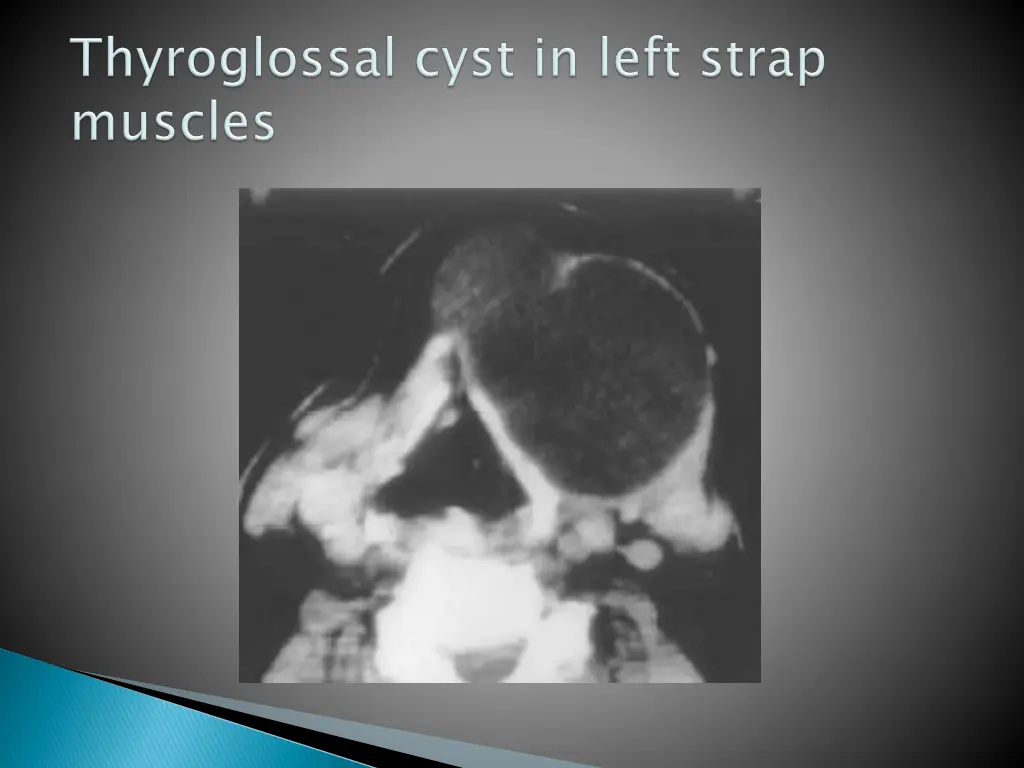 slide18