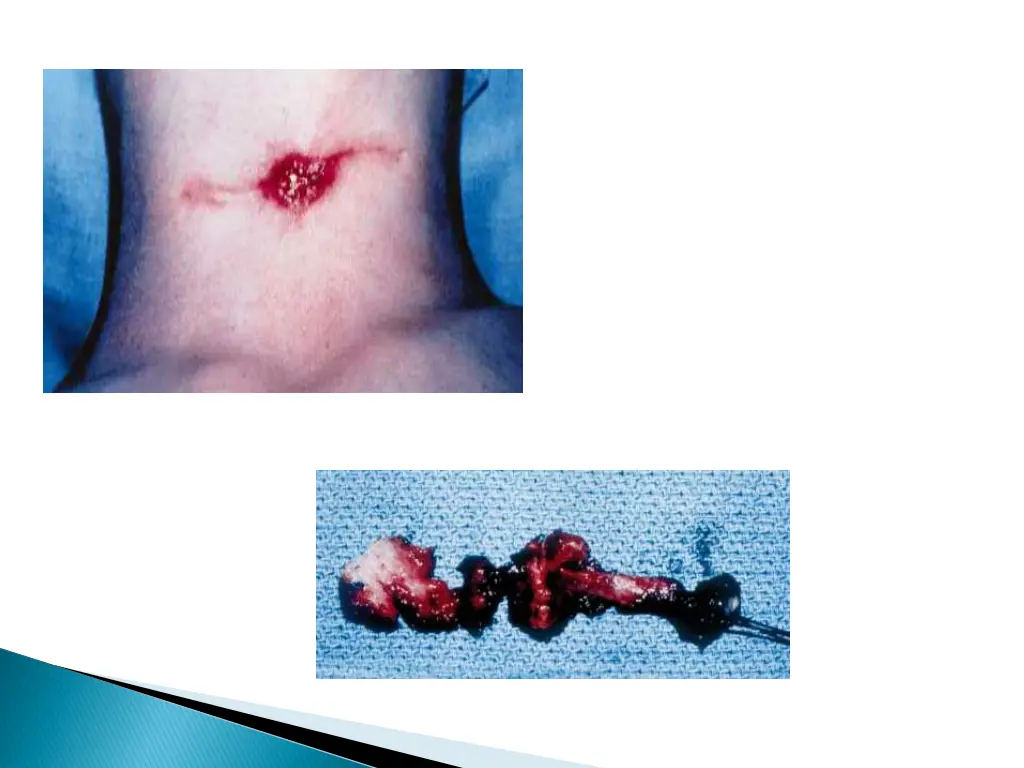 slide22