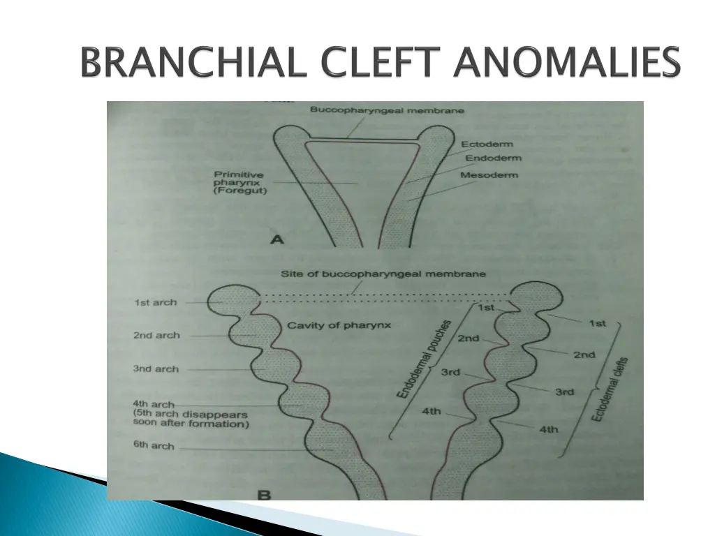 slide23