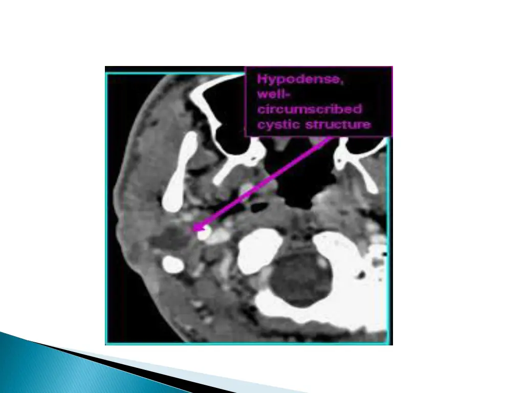 slide30