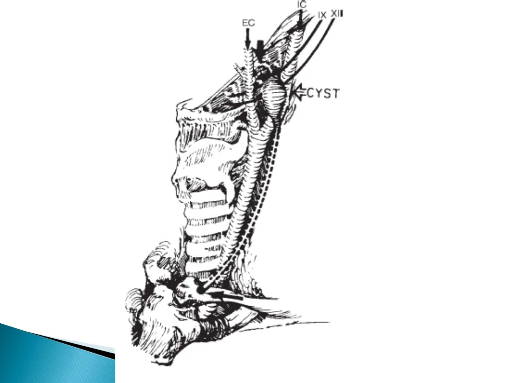 slide33