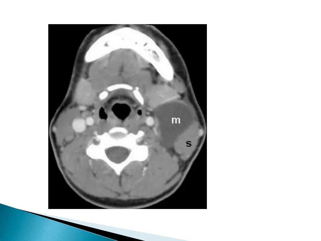 slide38