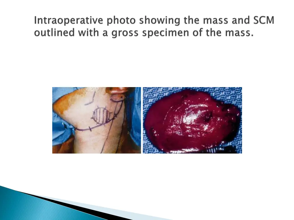 slide41
