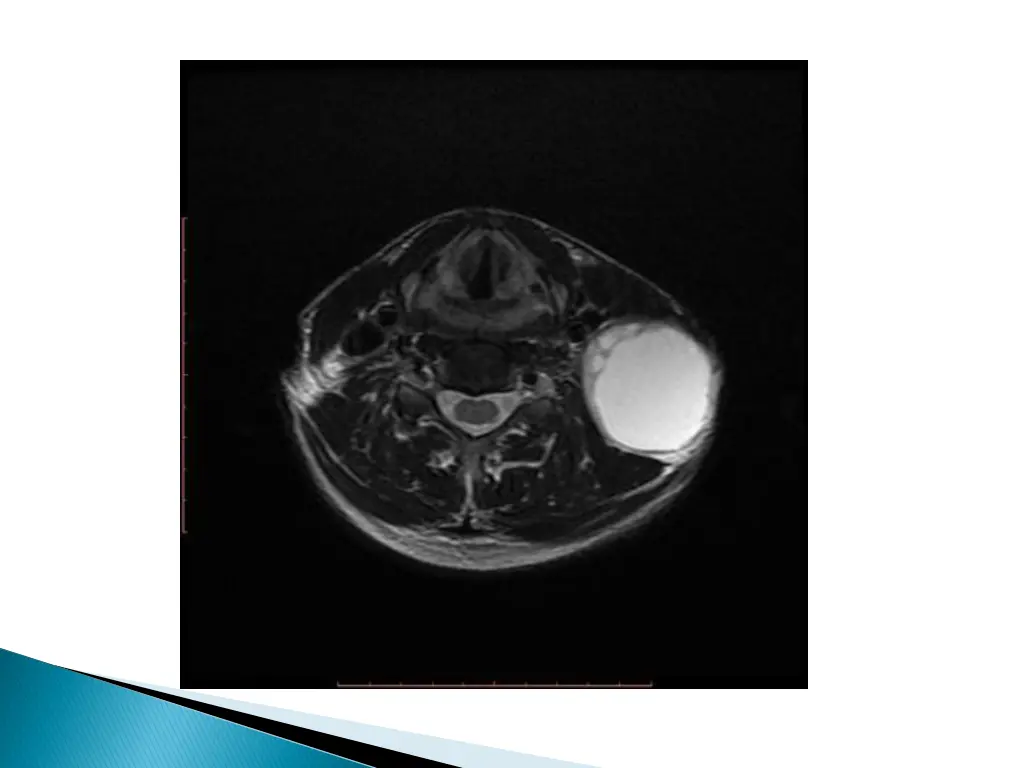 slide46