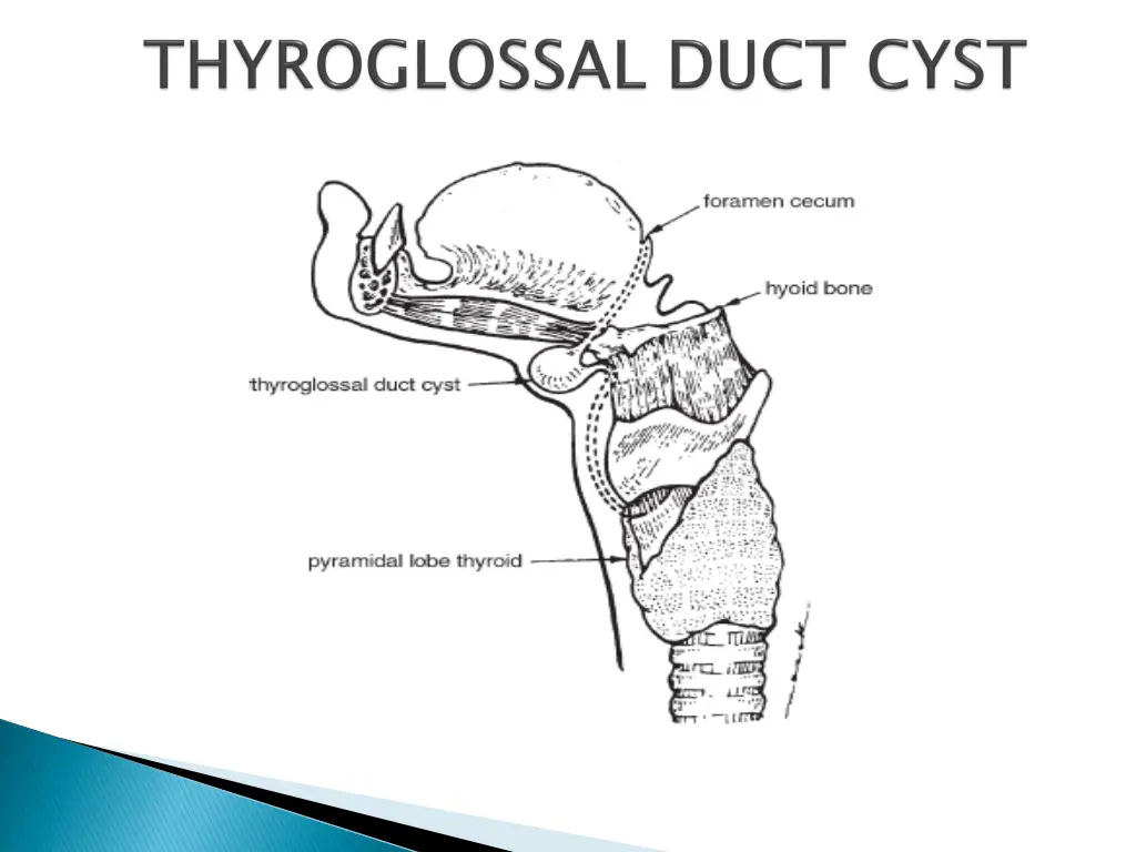 slide5