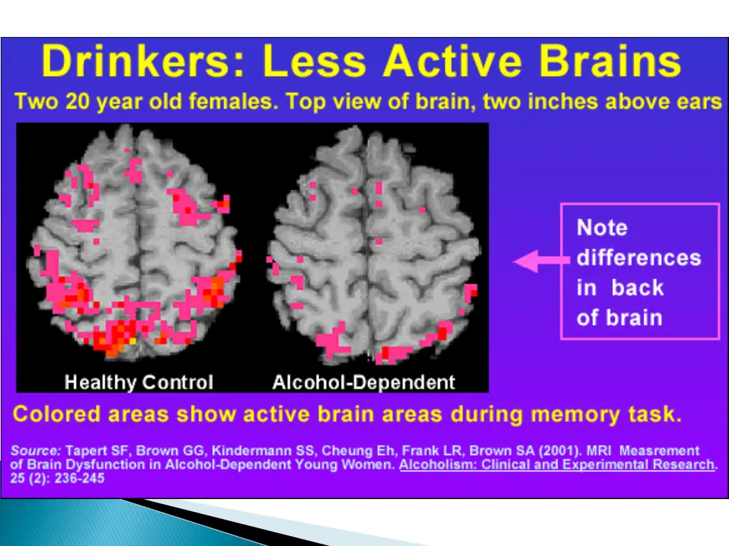 slide14