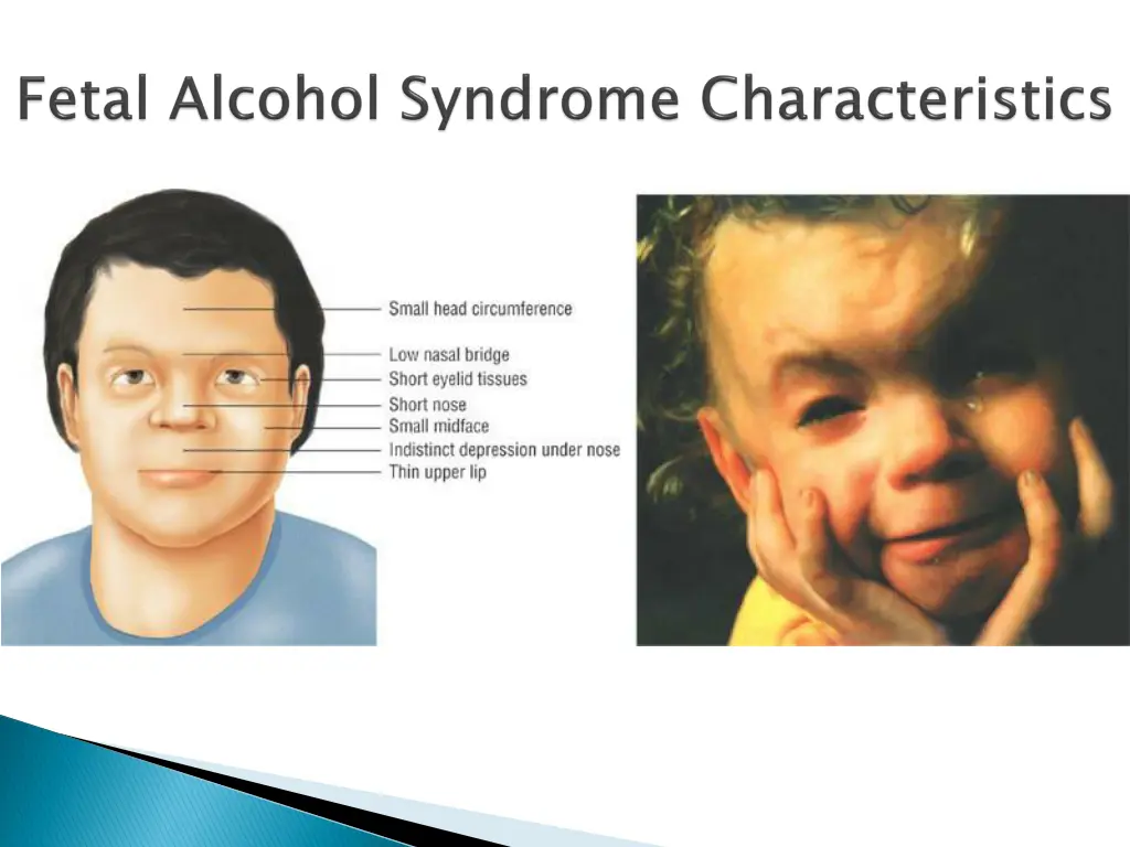 slide17