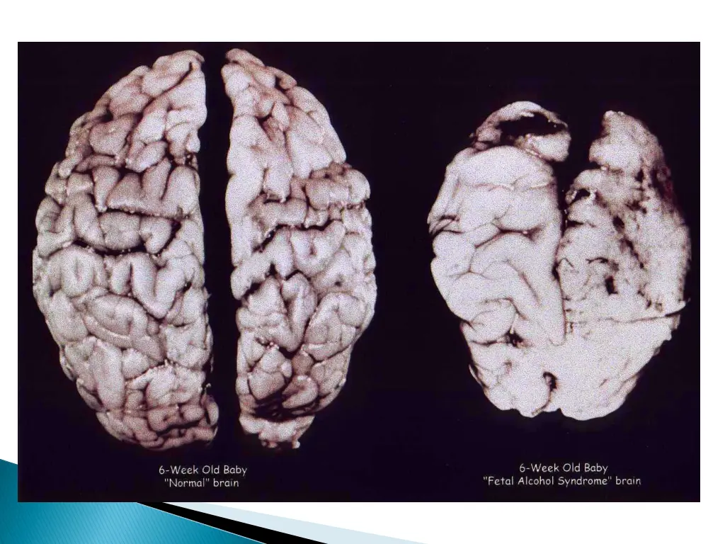slide18