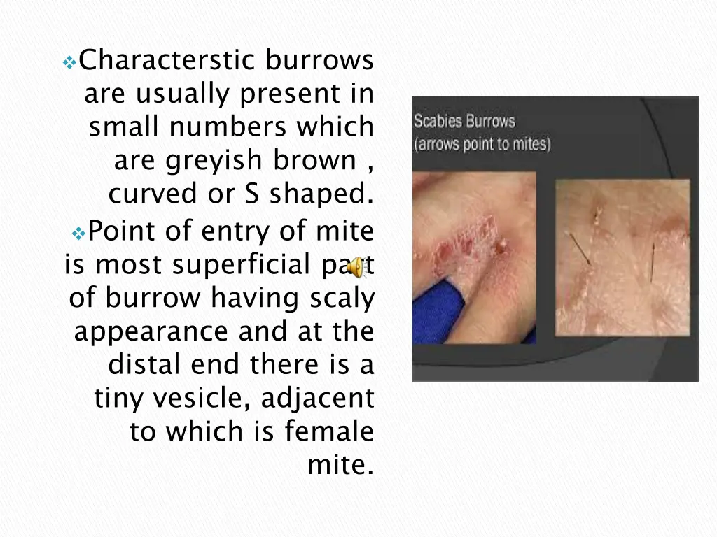 characterstic burrows are usually present