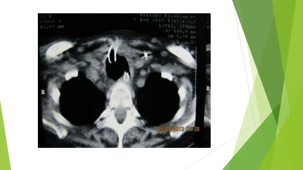 slide10