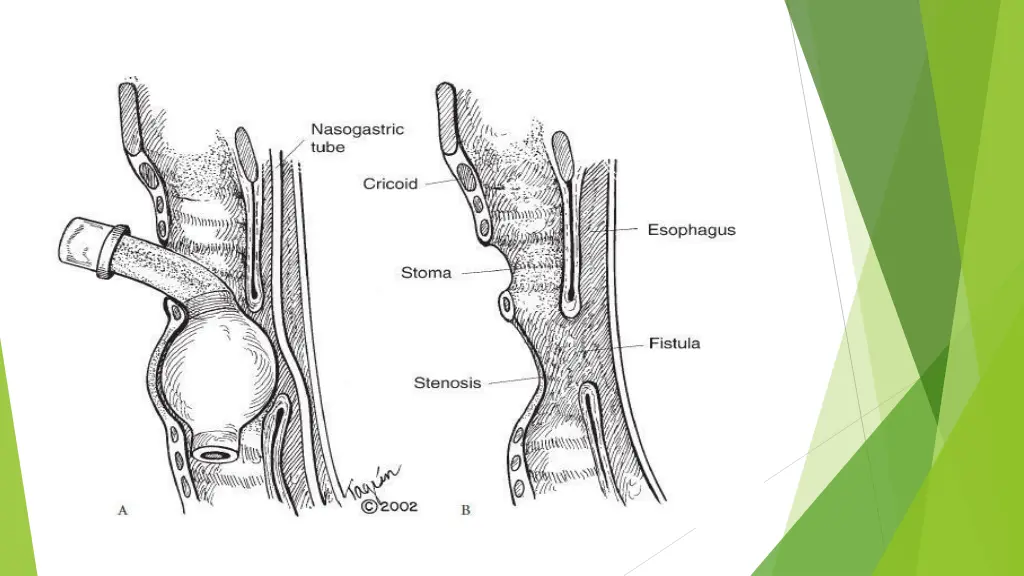 slide3
