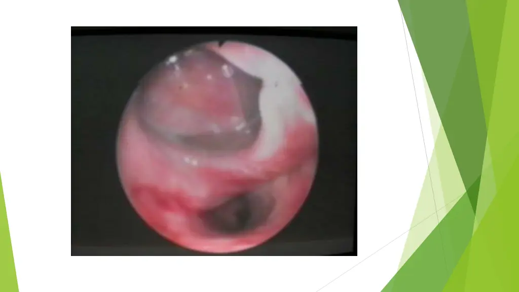 slide9
