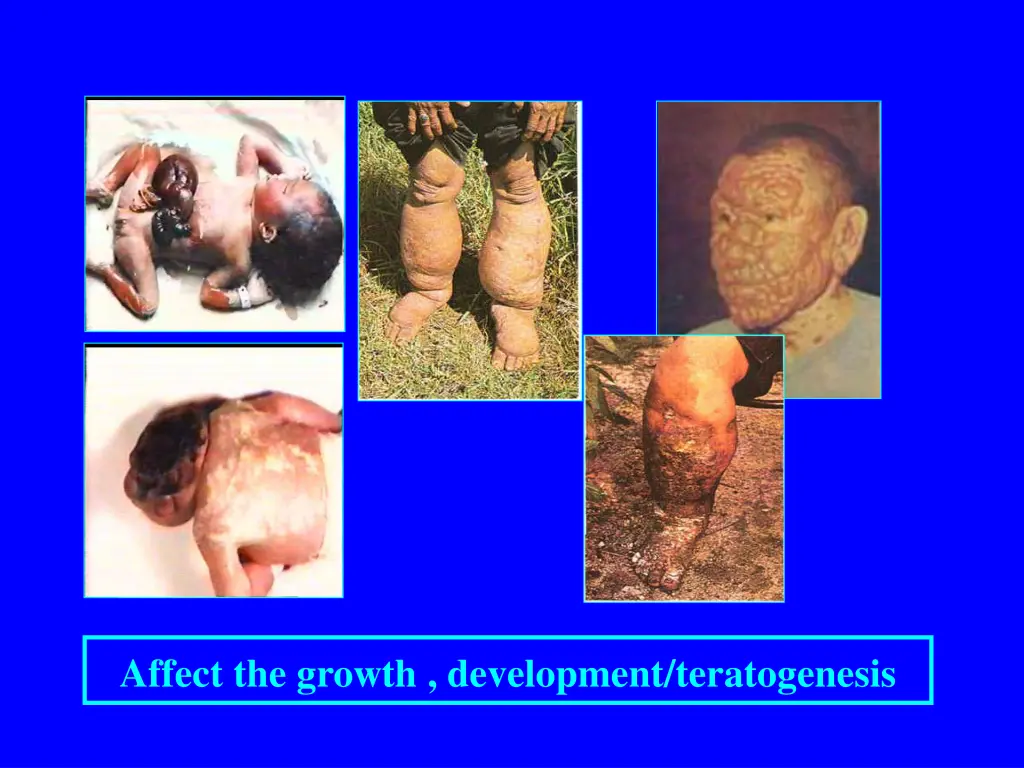 affect the growth development teratogenesis