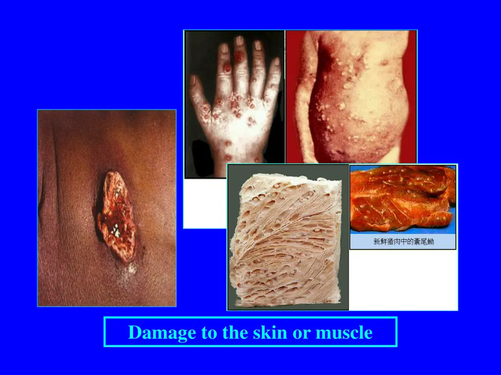 damage to the skin or muscle