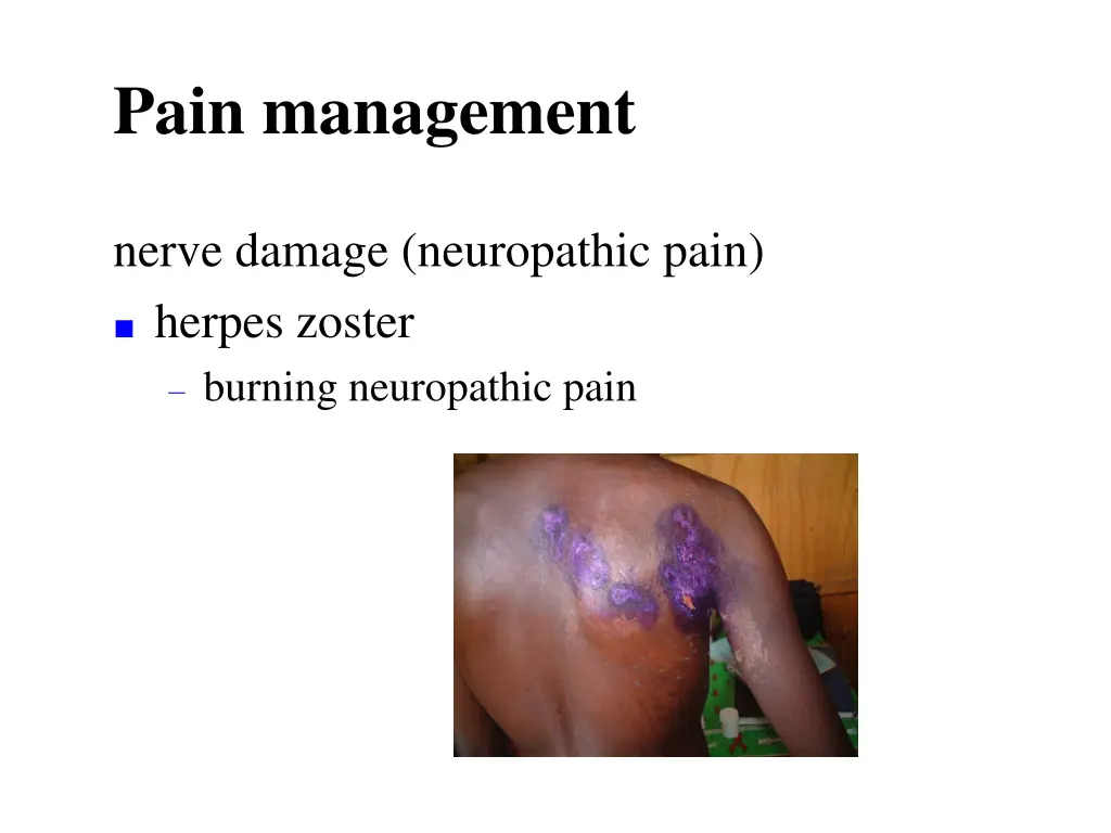 pain management 3