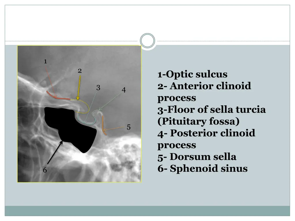slide10