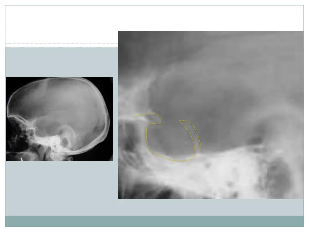 slide11