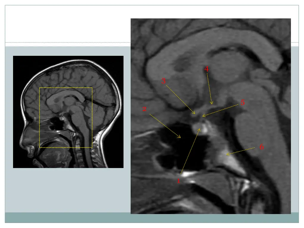 slide13