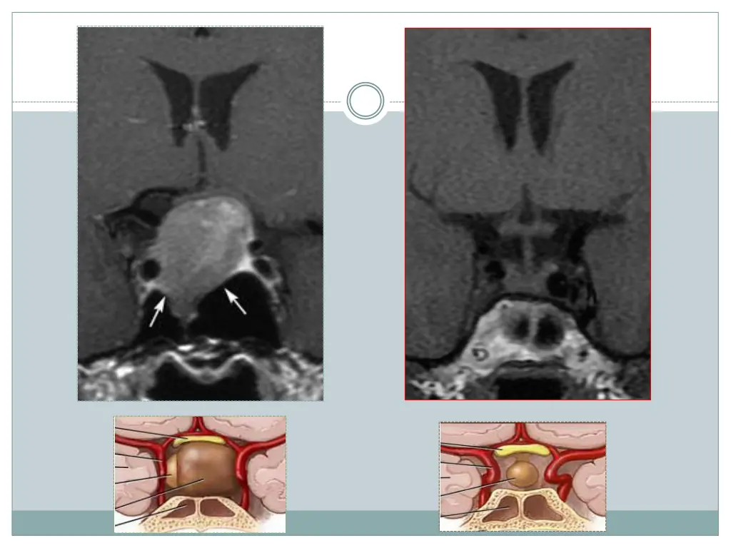 slide19