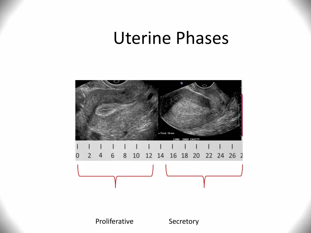 uterine phases