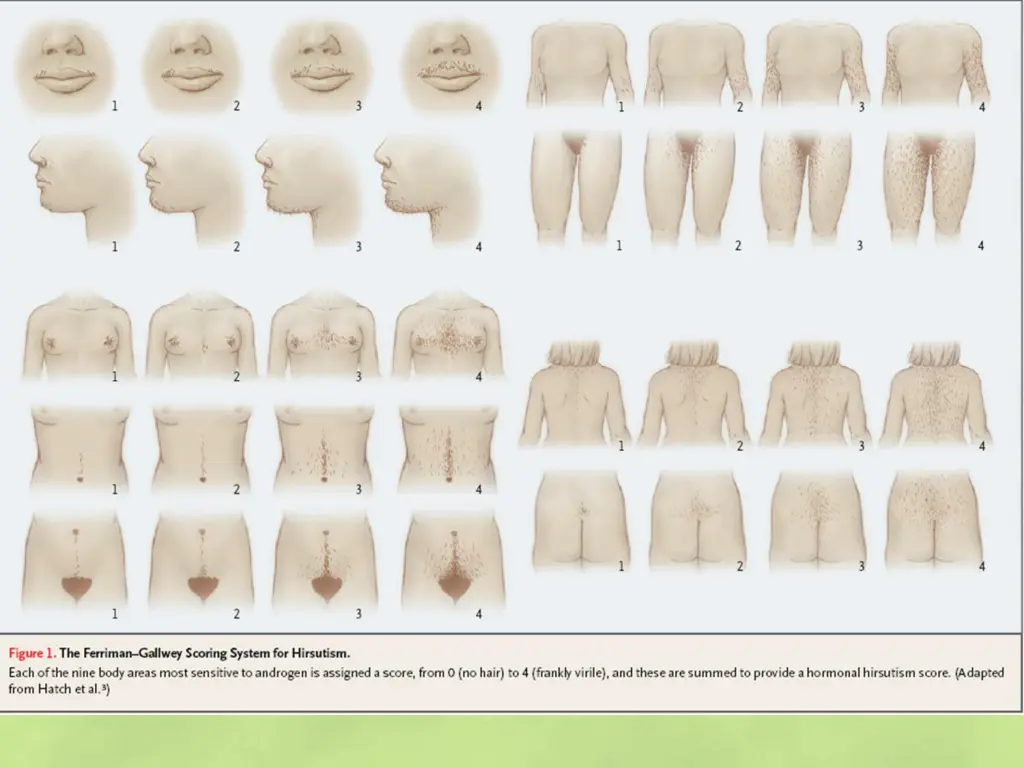 slide11
