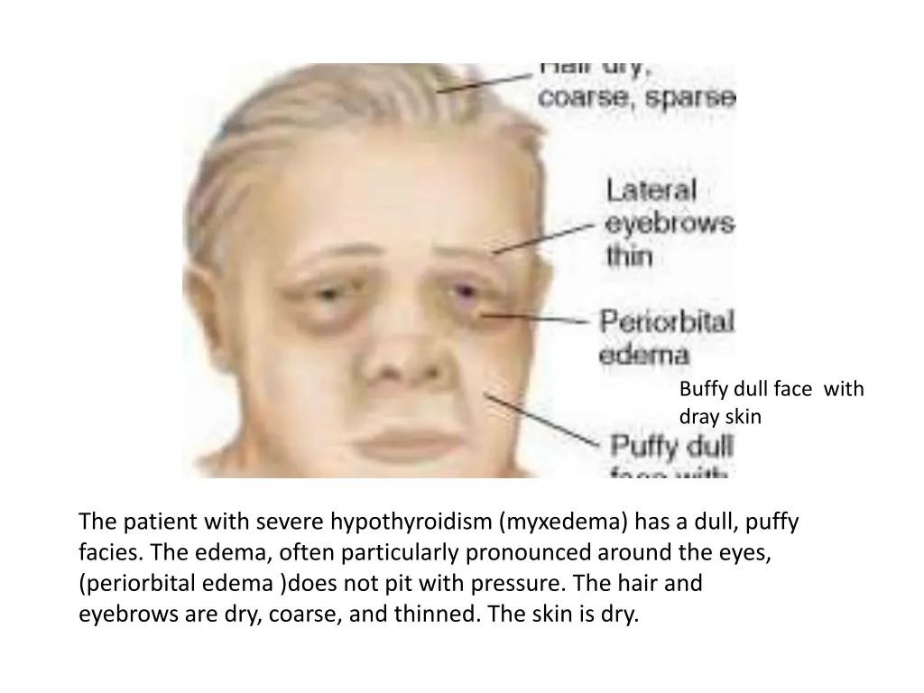 buffy dull face with dray skin