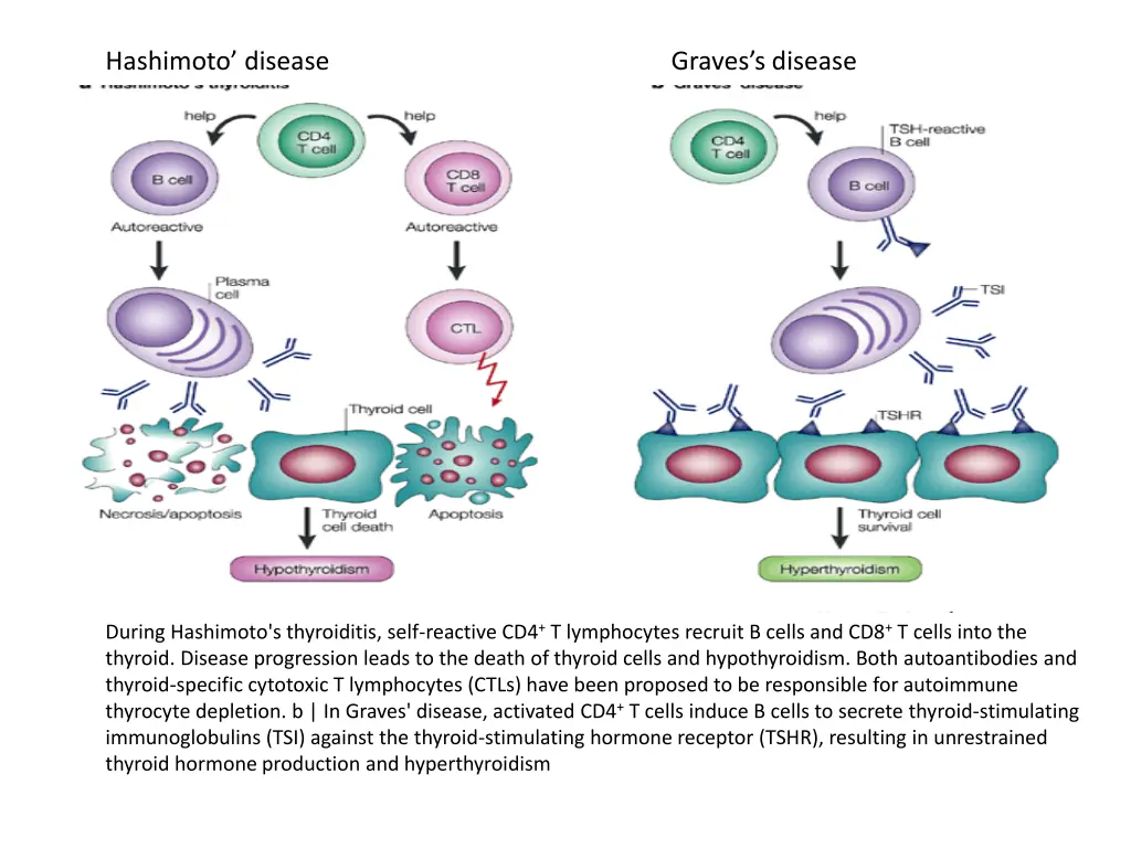hashimoto disease