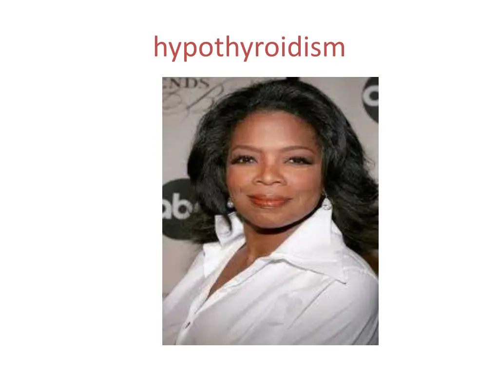 hypothyroidism 3