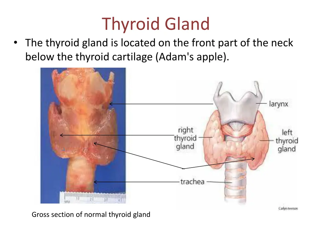 thyroid gland