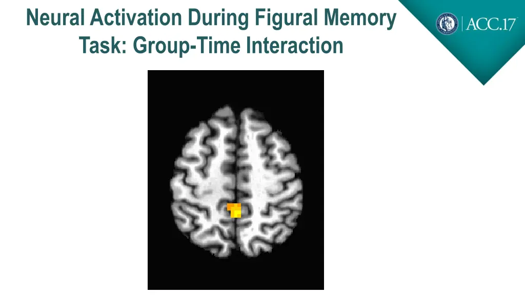 neural activation during figural memory task