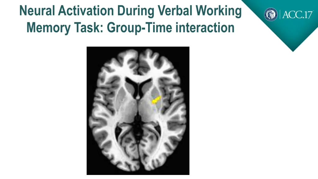 neural activation during verbal working memory