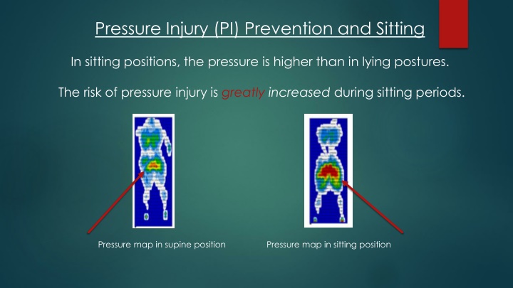 pressure injury pi prevention and sitting