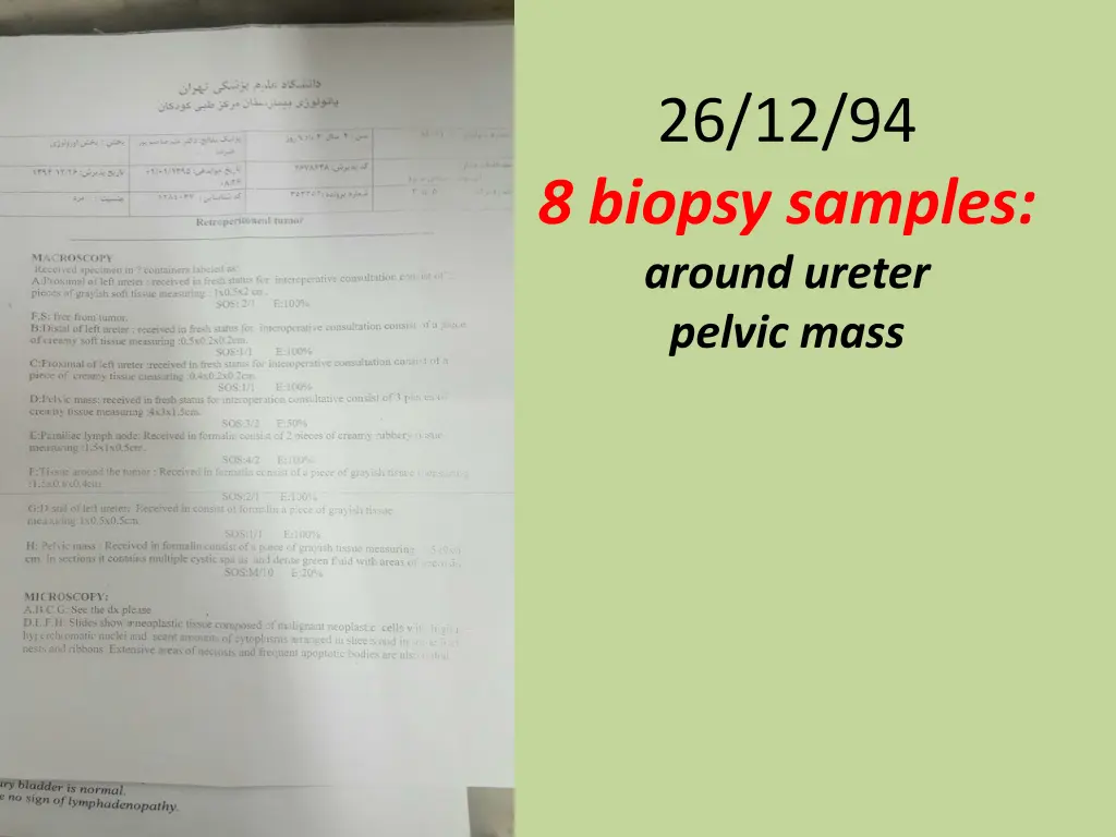 26 12 94 8 biopsy samples around ureter pelvic