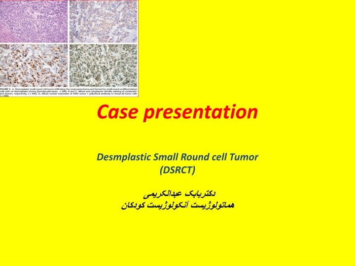 case presentation