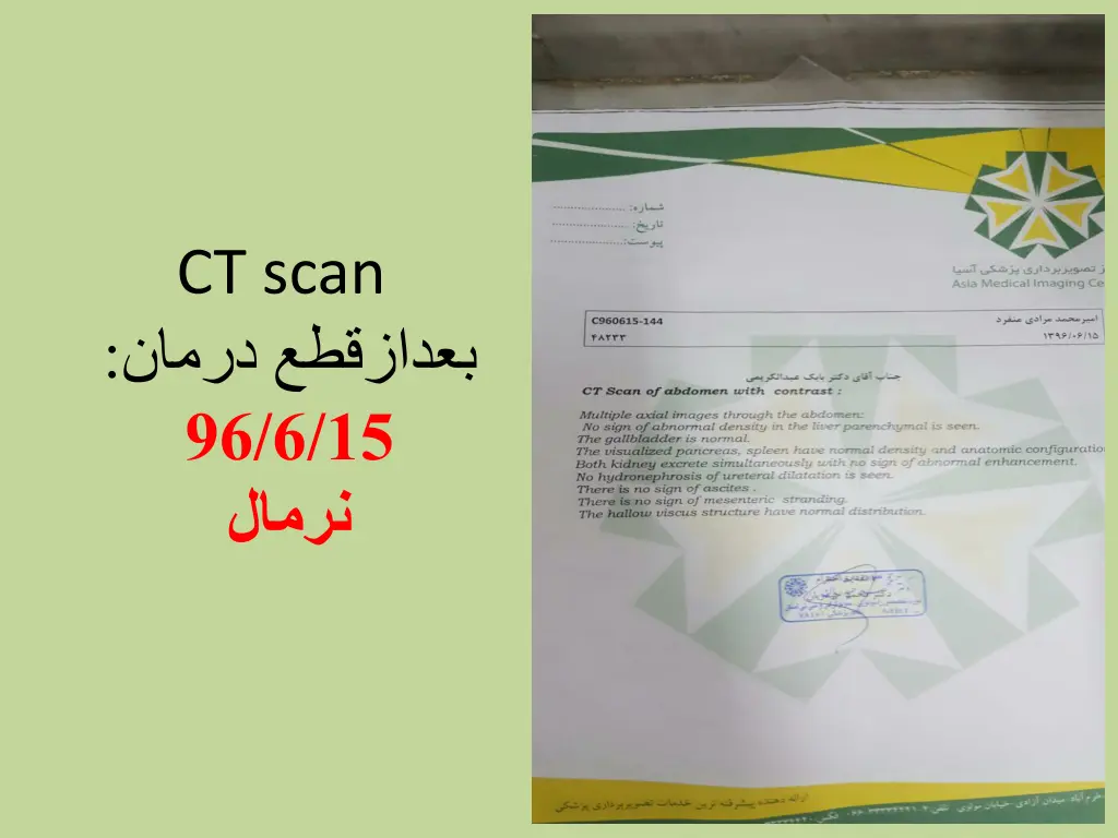 ct scan 96 6 15
