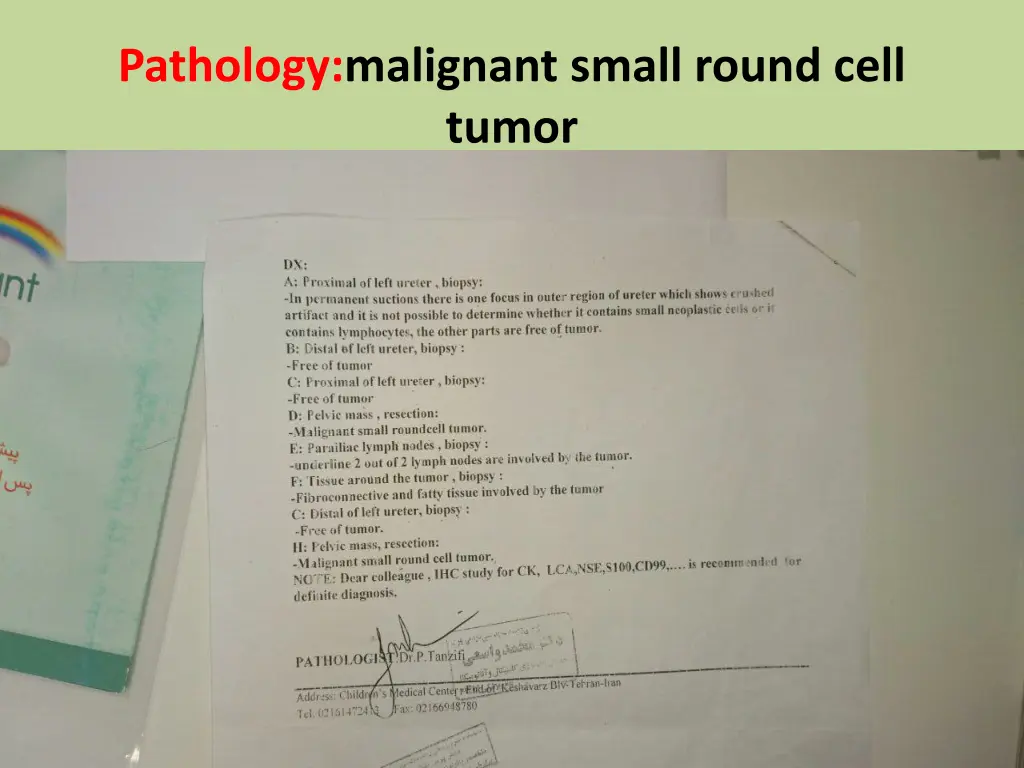 pathology malignant small round cell tumor