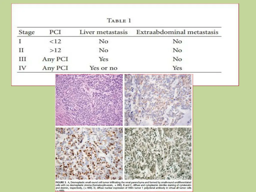 slide19
