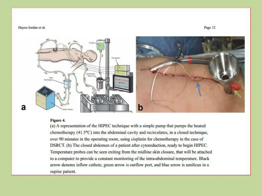 slide25