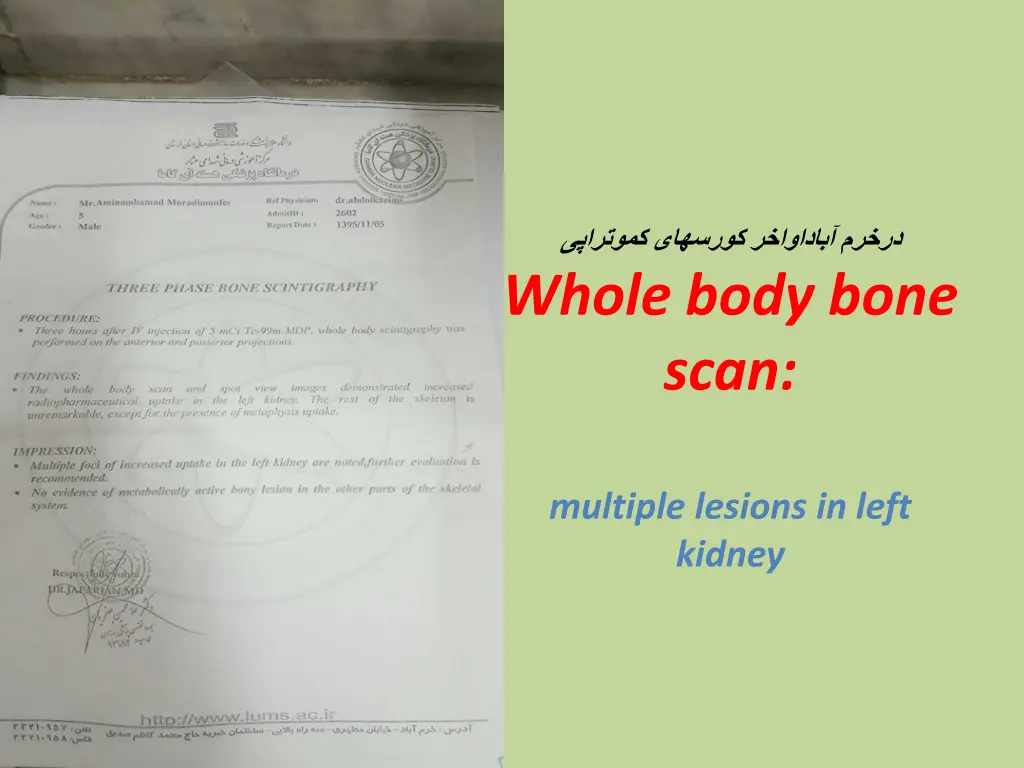 whole body bone scan