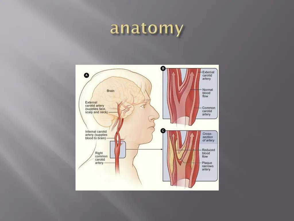 slide5