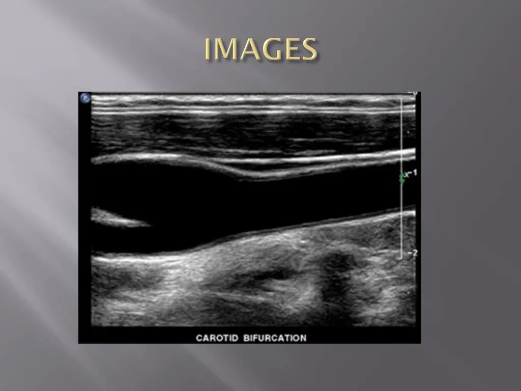 slide7