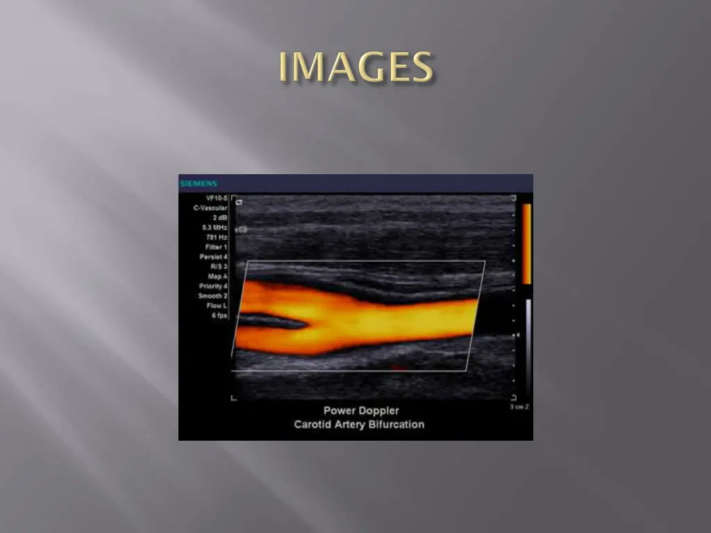 slide8