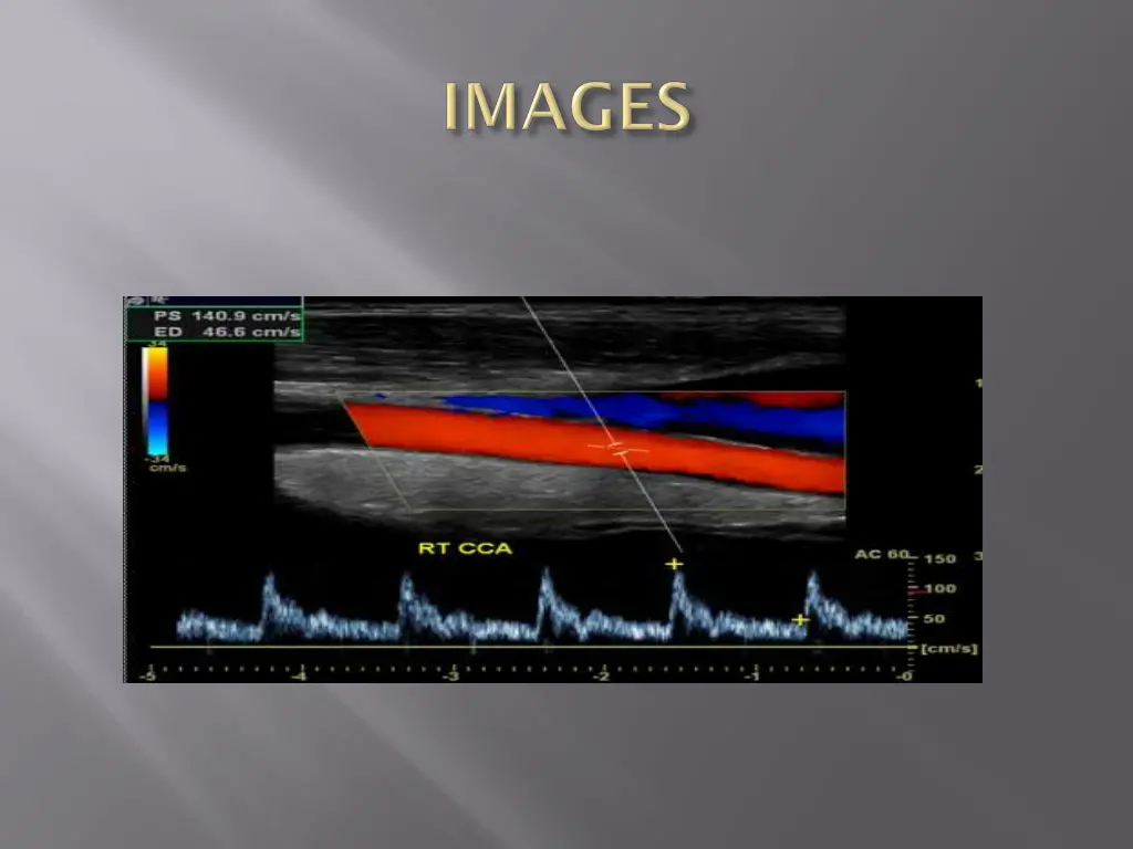 slide9