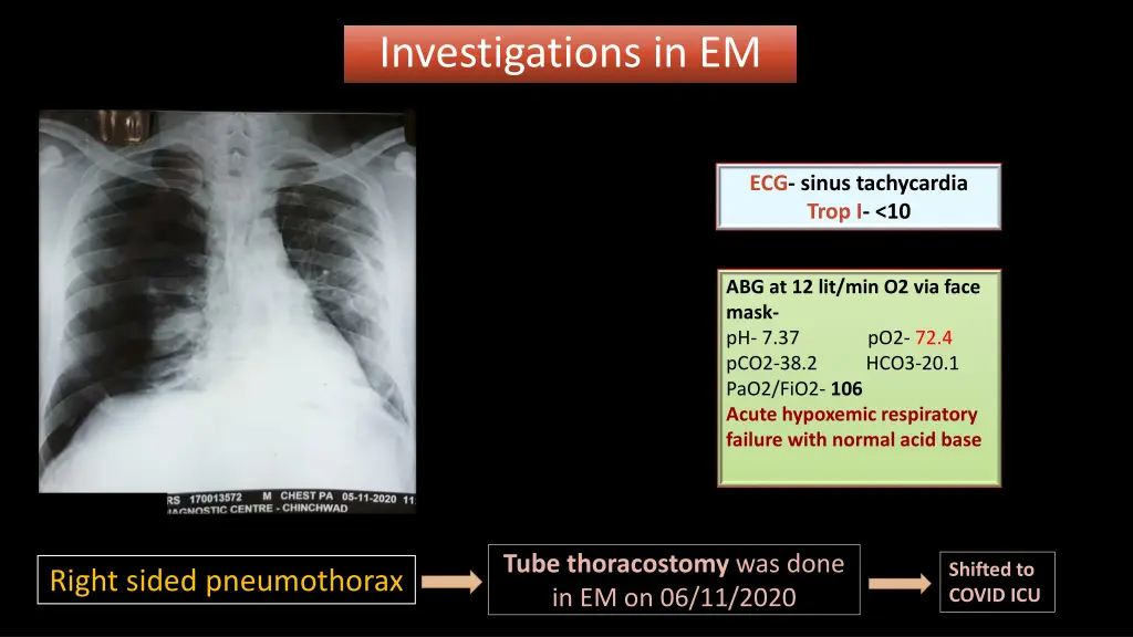 investigations in em
