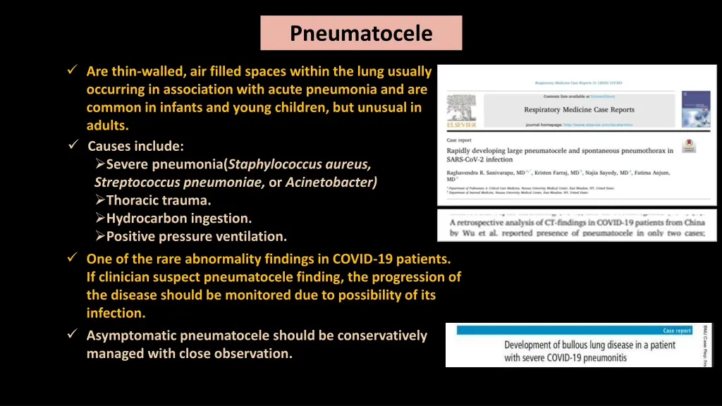 pneumatocele